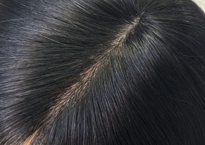 16″ 5×5″ HC Skin Closure #1 Black