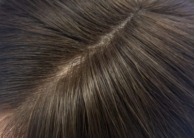 16″ 5×5″ HC Skin Closure #2/4 Dark Brown and Chocolate Brown Mixed