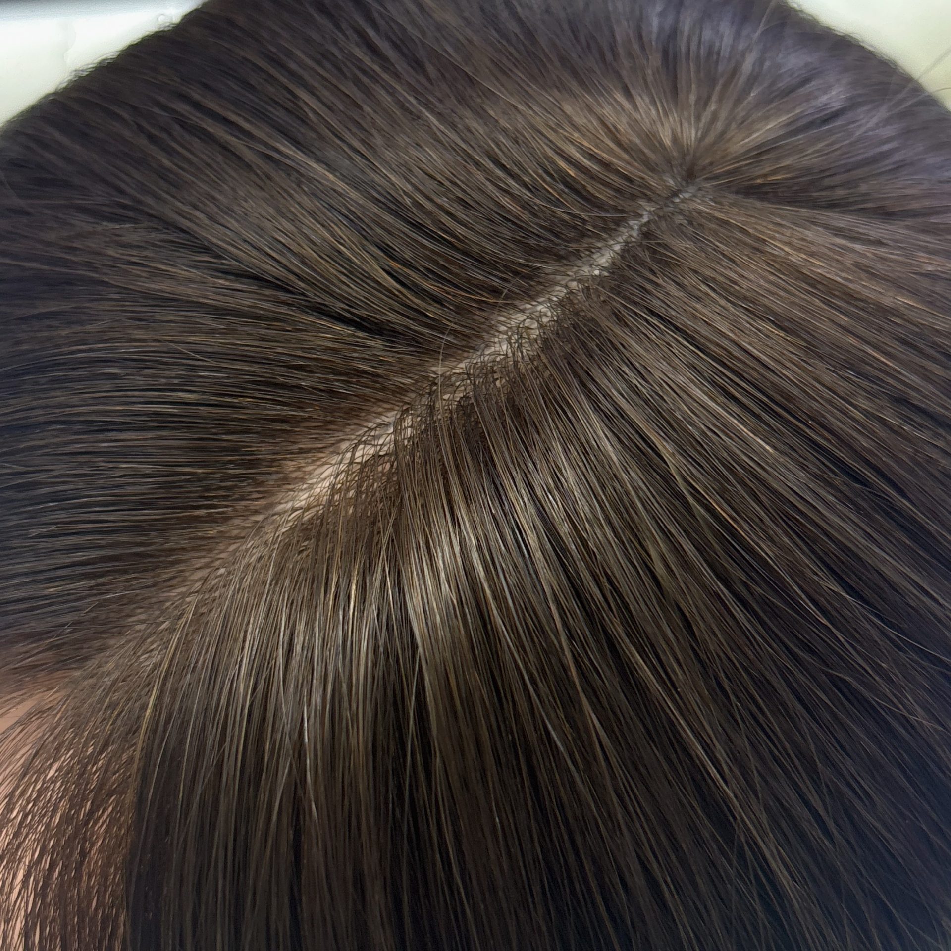 16" 5x5" HC Skin Closure #2/4 Dark Brown and Chocolate Brown Mixed