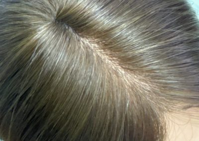 16″ 5×5″ HC Skin Closure #4 Chocolate Brown