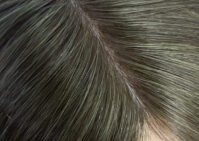 16″ 5×5″ HC Skin Closure #4/8 Chocolate and Light Brown Mixed