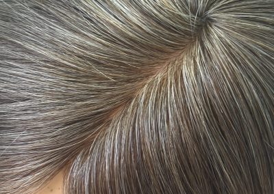 16″ 5×5″ HC Skin Closure #4/8/24 Mixed Browns