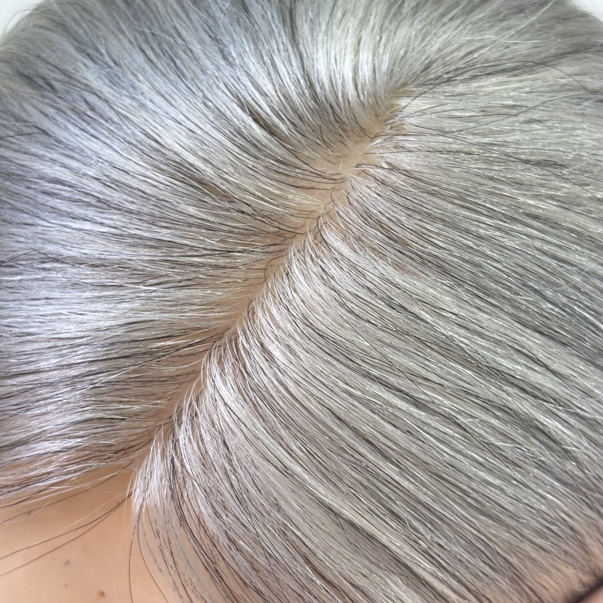 16" 5x5" HC Skin Closure #saltandpepper Salt and Pepper