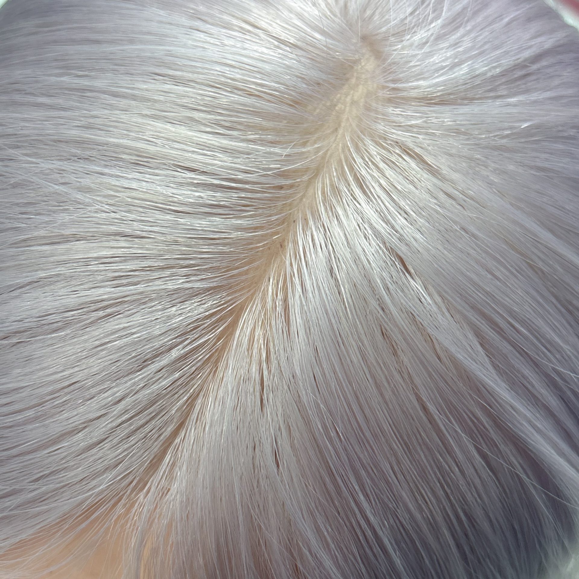 16" 5x5" HC Skin Closure #silver Silver